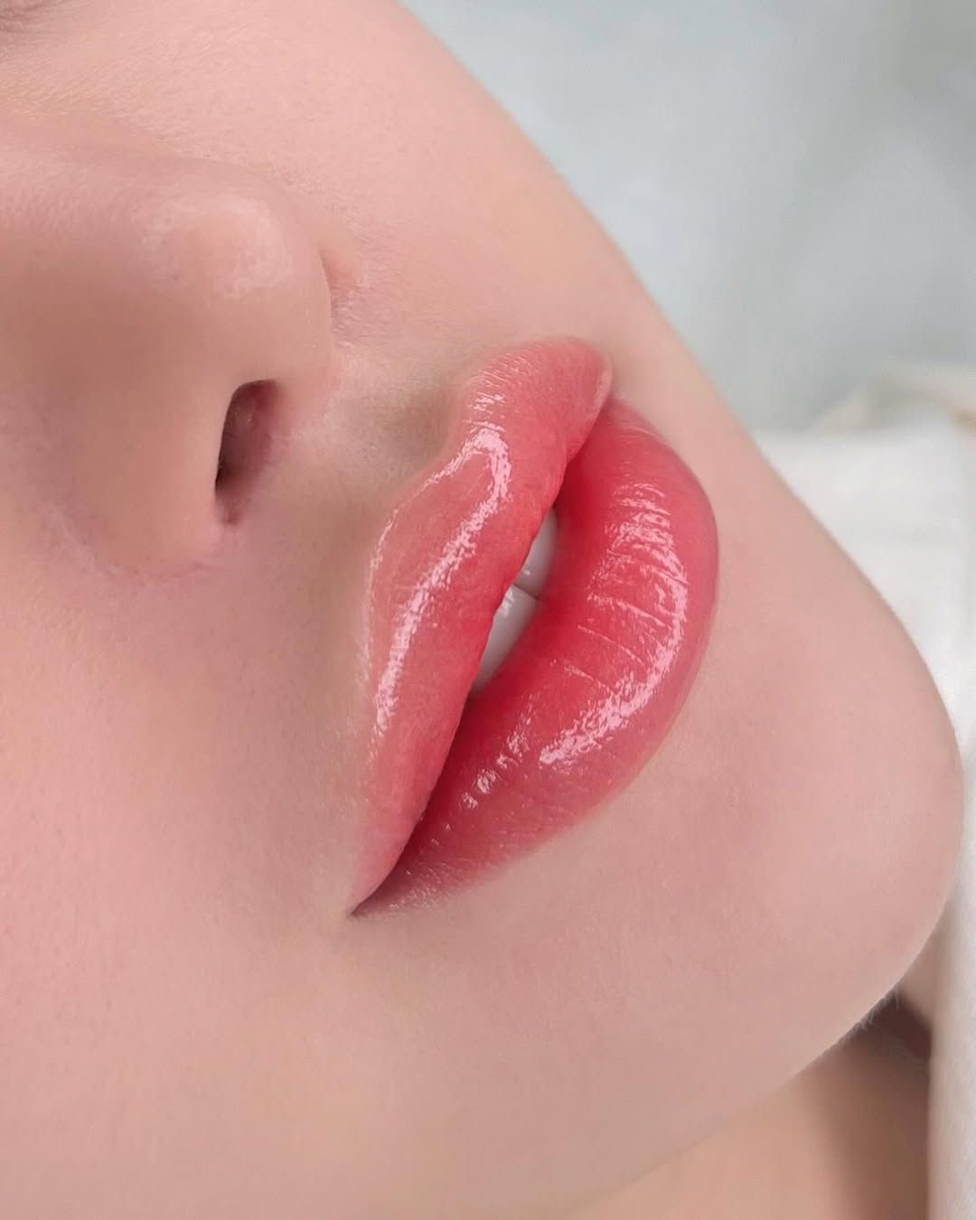 Phun môi Collagen